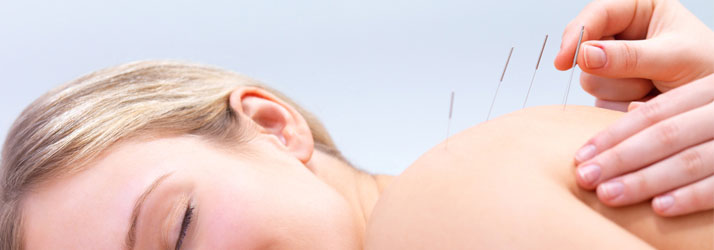 Chiropractic Broken Arrow OK Acupuncture Back Chiropractic Broken Arrow OK Acupuncture Back